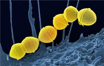 Group A Strep and scarlet fever: What look out for, what to do and where to find more information